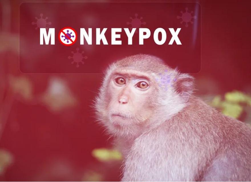 退退退！猴痘已入侵亞洲，糖友需警惕這些！